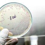 Petri dish displaying E. coli bacterial culture