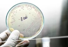 Petri dish displaying E. coli bacterial culture