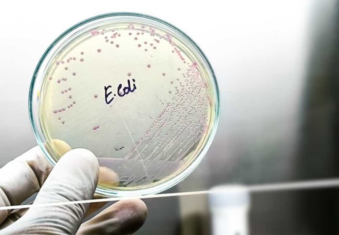 Petri dish displaying E. coli bacterial culture